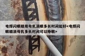 电焊闪眼睛用母乳滴眼多长时间能好