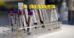 二氧化碳气体保护焊是否需要探伤检测？揭秘背后原因