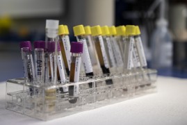 二氧化碳气体保护焊是否需要探伤检测？揭秘背后原因